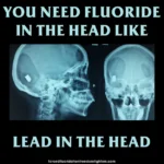 Caption: accumulation in the brain – X-rays of someone with a bullet in their head. Text at top: You need fluoride in the head like – Text at bottom: lead in the head
