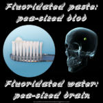 Caption: topical vs systemic – Toothbrush head with small blob of toothpaste on it. Human skull with pea inside it. Text at top: Fluoridated paste: pea-sized blob – Text at bottom: Fluoridated water: pea-sized brain